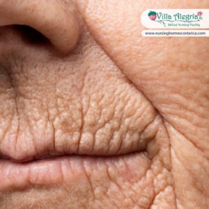 Skin Care in Older Adults